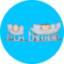 3D-Druck von Zähnen