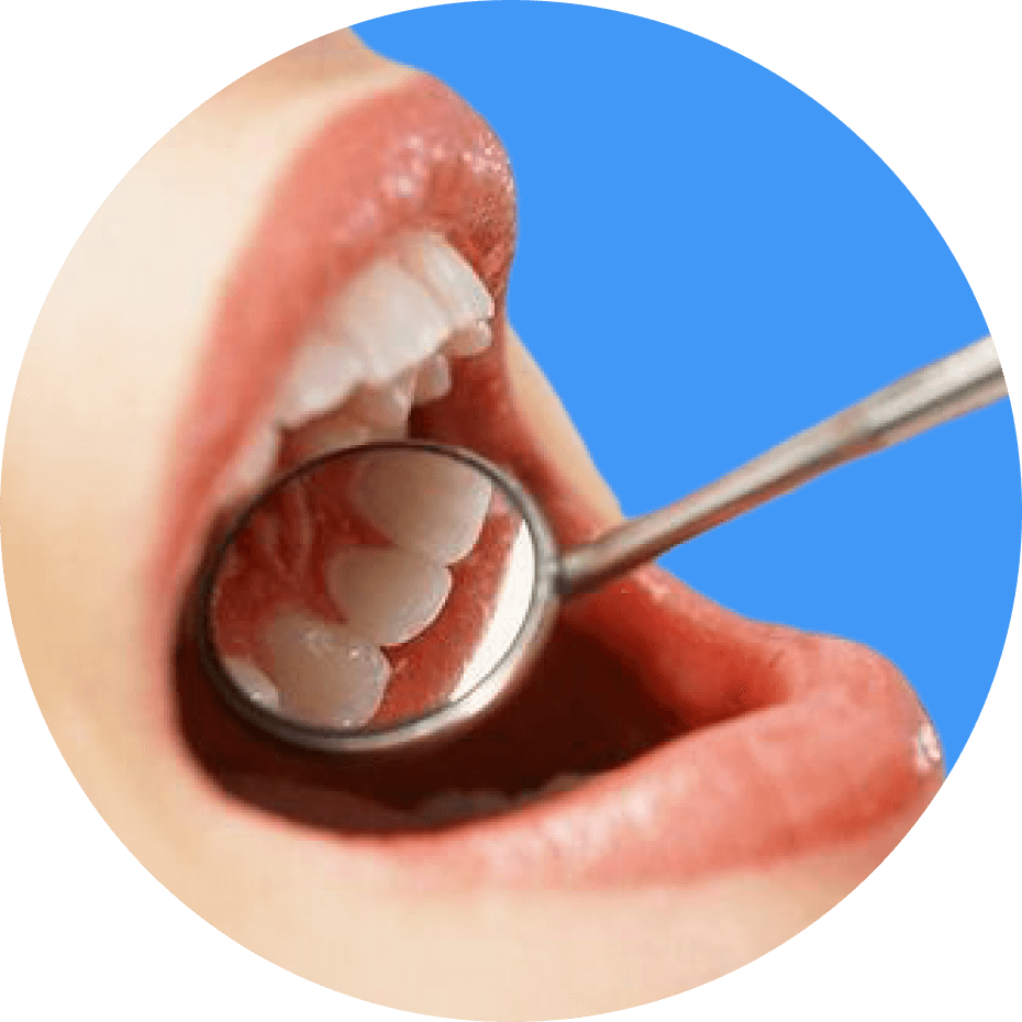 Bestimmung der Zahnmobilität