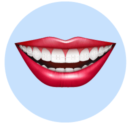 Zahnspangen-aus-künstllichem-Saphir